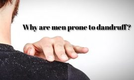 Why are men prone to dandruff?